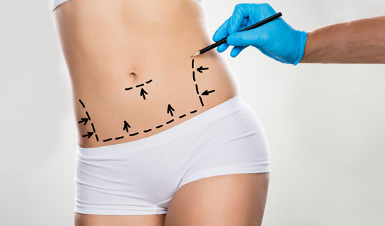 Abdominoplastie en Turquie