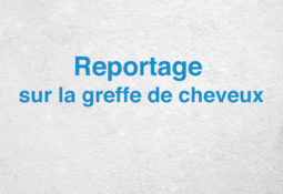 Témoignage d’un patient Greffe de cheveux