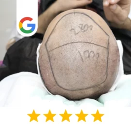 google-comment-lp-Benjamin Starcevic