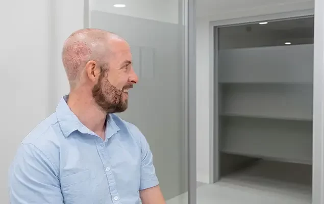 Greffe-de-cheveux-et-de-barbe