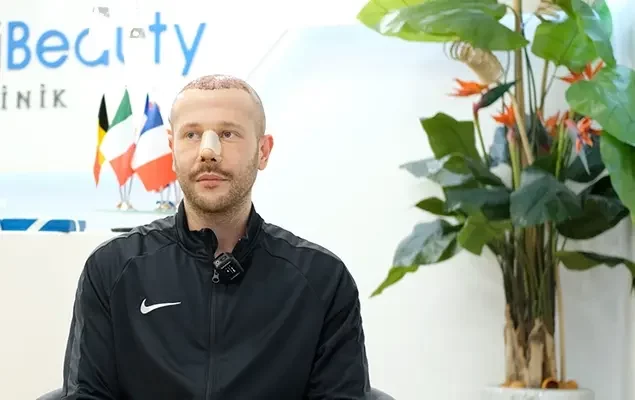 Greffe-de-cheveux-et-rhinoplastie